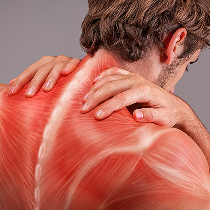 Die Wahrheit über den Muskelkater